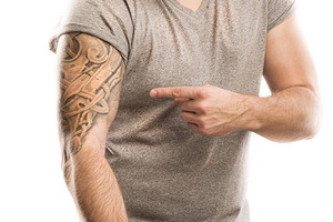 Laser Tattoo Removal in Chadstone: One Session from ONLY $29