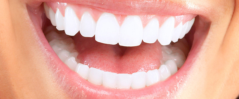 In-Chair LED Teeth Whitening at Melbourne Central – $39 for One Session, $69 for Two Sessions, $89 for Three Sessions or $129 for Five Sessions (Valued Up To $676)